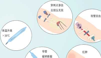 picc导管是什么材质【健康科普】什么是PICC？_https://www.jmylbn.com_新闻资讯_第38张