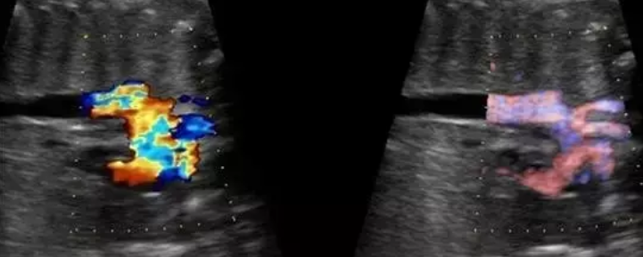 彩超怎么判断故障干货！彩超维修五步法_https://www.jmylbn.com_新闻资讯_第5张