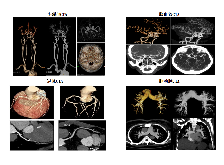 联影的CT怎么样【新设备】我院放射科联影80排CT正式投入使用_https://www.jmylbn.com_新闻资讯_第4张