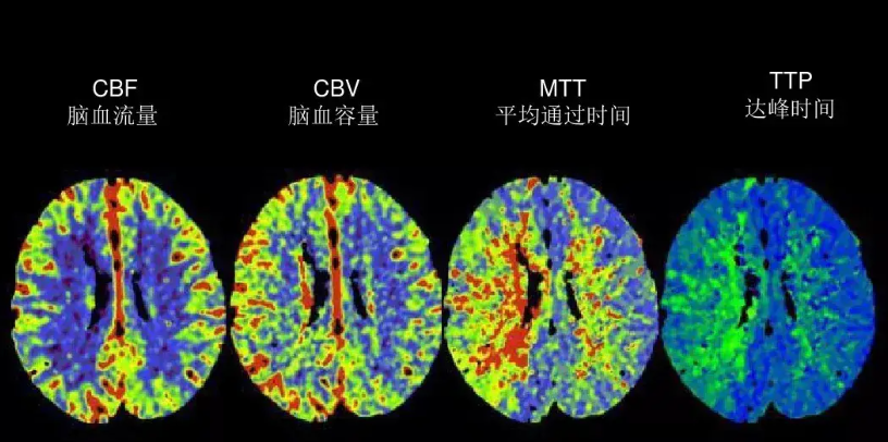 联影的CT怎么样【新设备】我院放射科联影80排CT正式投入使用_https://www.jmylbn.com_新闻资讯_第11张