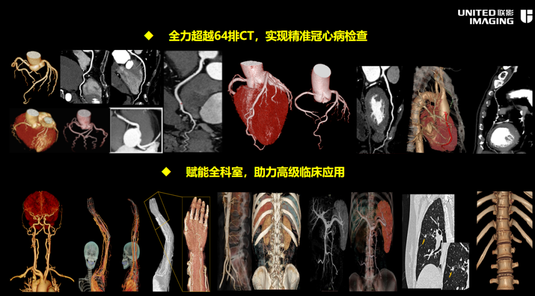联影的CT怎么样【新设备】我院放射科联影80排CT正式投入使用_https://www.jmylbn.com_新闻资讯_第8张