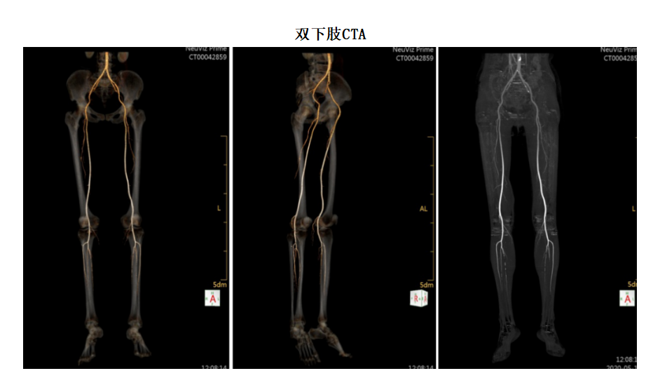 联影的CT怎么样【新设备】我院放射科联影80排CT正式投入使用_https://www.jmylbn.com_新闻资讯_第5张
