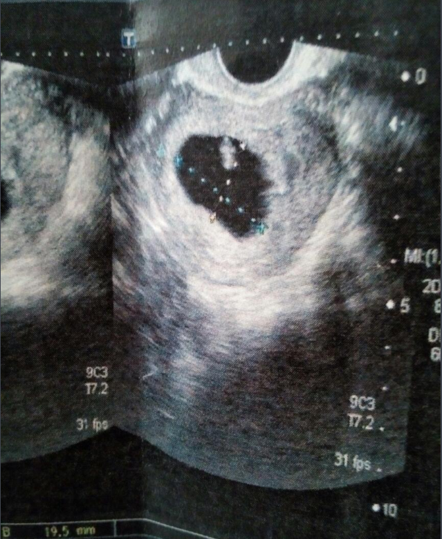 b超仪器什么牌子好彩超里的“彩”，五颜六色的东西是什么？_https://www.jmylbn.com_新闻资讯_第5张