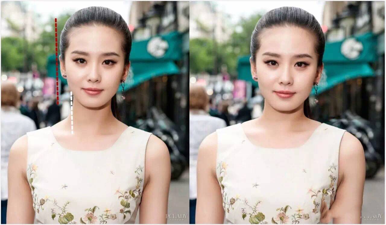这些当红明星怎么解决头大的问题
