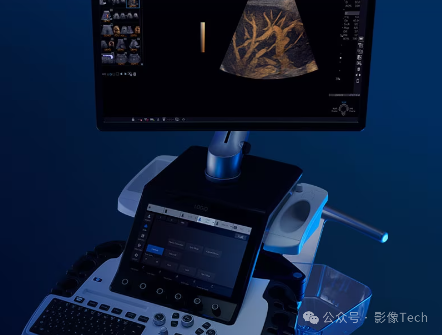 logiq e怎么读新品！GE医疗新一代超声产品组合_https://www.jmylbn.com_新闻资讯_第3张