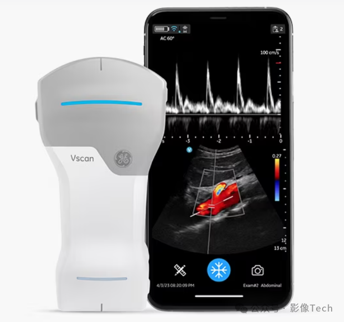 logiq e怎么读新品！GE医疗新一代超声产品组合_https://www.jmylbn.com_新闻资讯_第5张