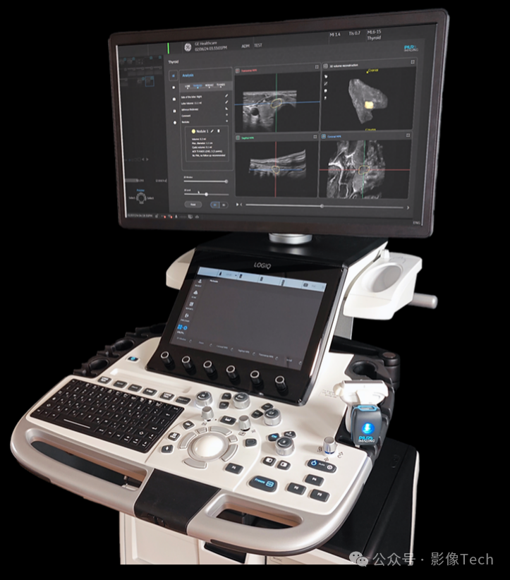 logiq e怎么读新品！GE医疗新一代超声产品组合_https://www.jmylbn.com_新闻资讯_第4张