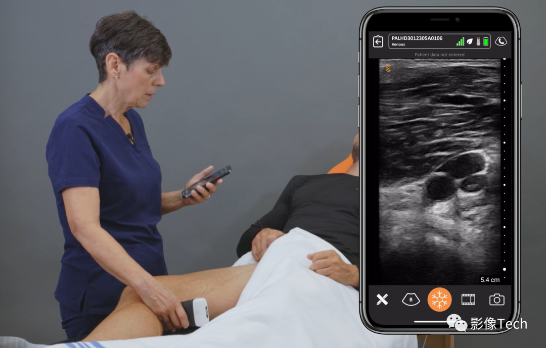 med复制粘贴怎么移动Clarius Mobile Health ：首款！双阵列手持式无线超声扫描仪_https://www.jmylbn.com_新闻资讯_第2张