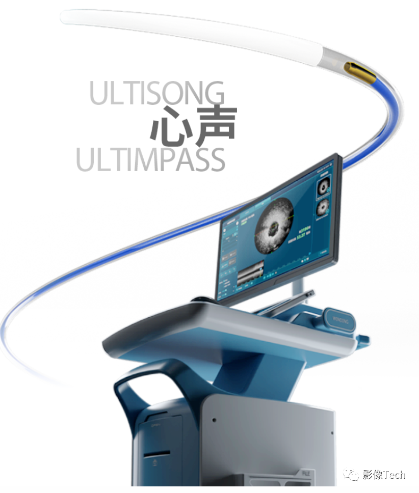 血管超声品牌有哪些盘点5家血管内超声企业！_https://www.jmylbn.com_新闻资讯_第12张