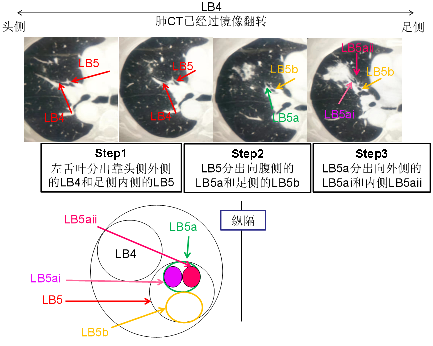 镜像翻转软件_图片镜像翻转在线_图片镜像翻转在线