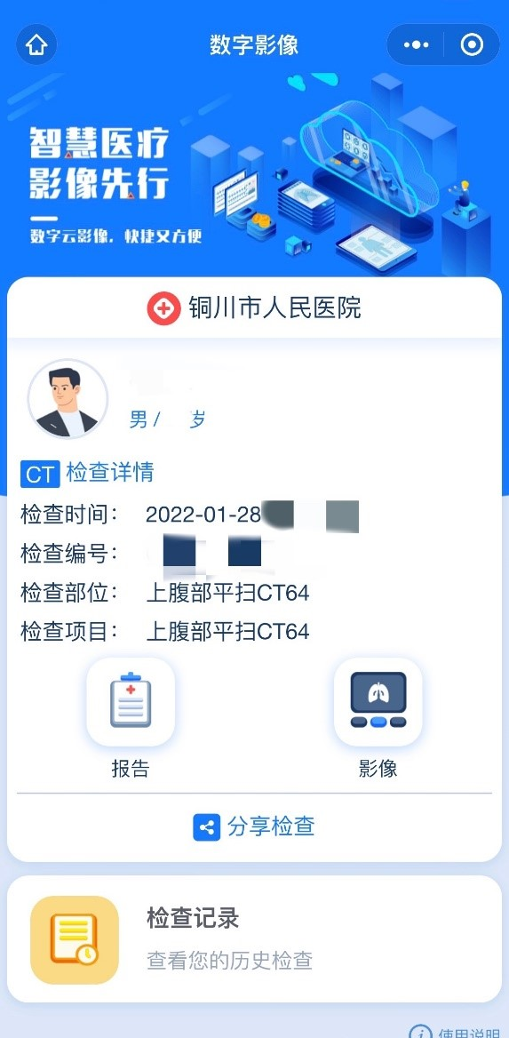 医用胶片怎么看我为群众办实事 ｜ 手机扫一扫，拍片结果随时随地看！我院“智能云胶片”让您体验便捷服务_https://www.jmylbn.com_新闻资讯_第7张