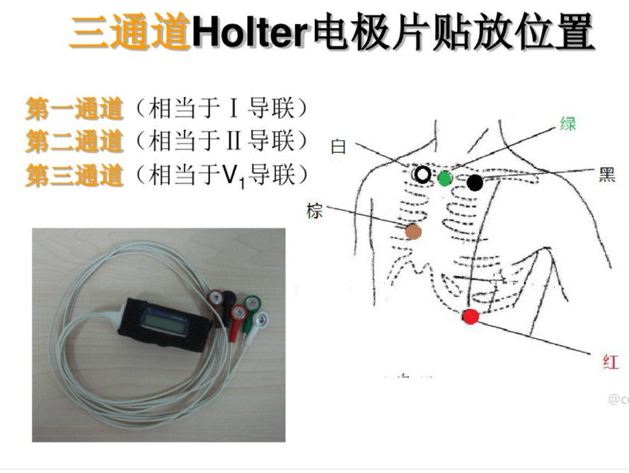 怎么装动态心电图手把手教你如何在龙台医院做动态心电图_https://www.jmylbn.com_新闻资讯_第12张