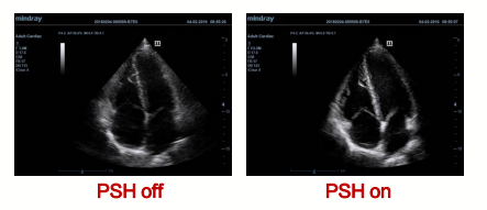 迈瑞彩超有哪些型号迈瑞彩超机器_https://www.jmylbn.com_新闻资讯_第37张