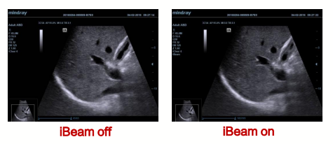 迈瑞彩超有哪些型号迈瑞彩超机器_https://www.jmylbn.com_新闻资讯_第38张