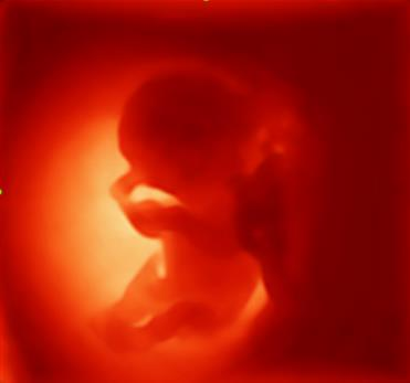 迈瑞彩超有哪些型号迈瑞彩超机器_https://www.jmylbn.com_新闻资讯_第42张