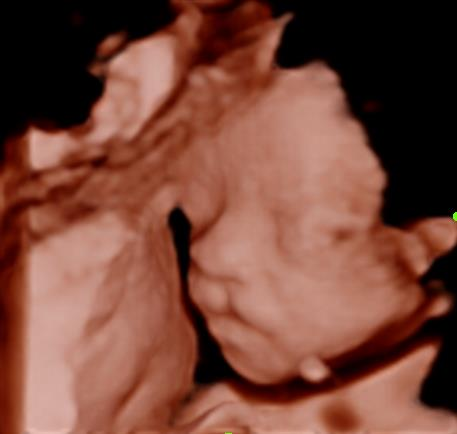 迈瑞彩超有哪些型号迈瑞彩超机器_https://www.jmylbn.com_新闻资讯_第43张