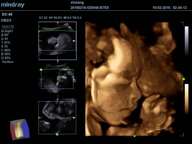 迈瑞彩超有哪些型号迈瑞彩超机器_https://www.jmylbn.com_新闻资讯_第41张