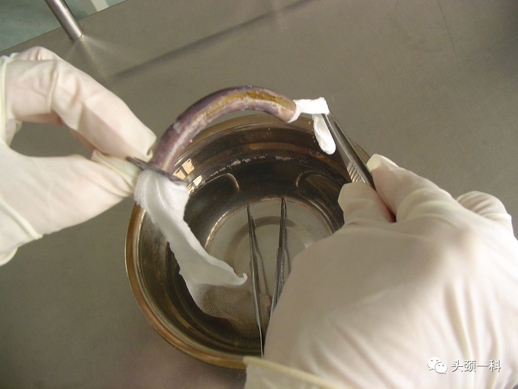 气管套管怎么换药您知道带着气管套管回家以后需要如何护理吗？_https://www.jmylbn.com_新闻资讯_第11张