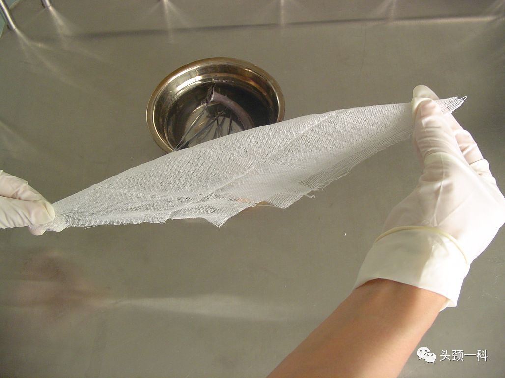 气管套管怎么换药您知道带着气管套管回家以后需要如何护理吗？_https://www.jmylbn.com_新闻资讯_第10张