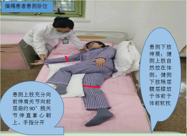 医用病床怎么移动图解【商医话健康】护士引领之声 · 第112期 ｜  超全图解！偏瘫患者体位摆放及体位转移_https://www.jmylbn.com_新闻资讯_第6张