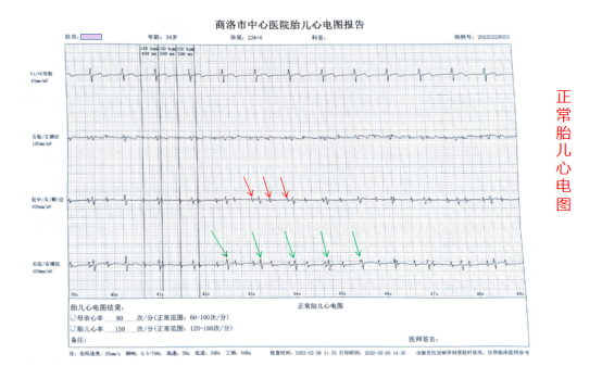 胎儿超声心电图是什么商医话健康 ｜ 心脏健康  从胎儿做起_https://www.jmylbn.com_新闻资讯_第8张