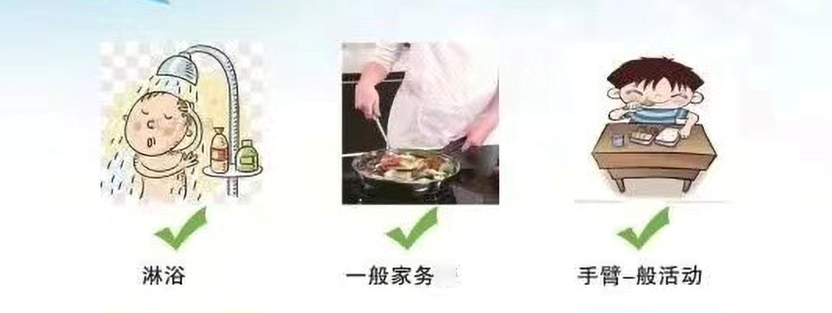 picc导管是什么材质关于PICC，您需要了解的那些事儿_https://www.jmylbn.com_新闻资讯_第7张