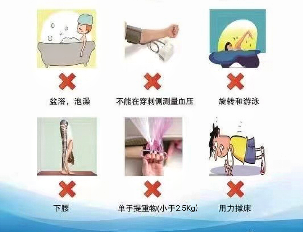 picc导管是什么材质关于PICC，您需要了解的那些事儿_https://www.jmylbn.com_新闻资讯_第8张