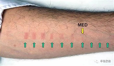 光疗时为什么黑眼罩半岛家用308准分子光疗仪最全操作指南_https://www.jmylbn.com_新闻资讯_第5张