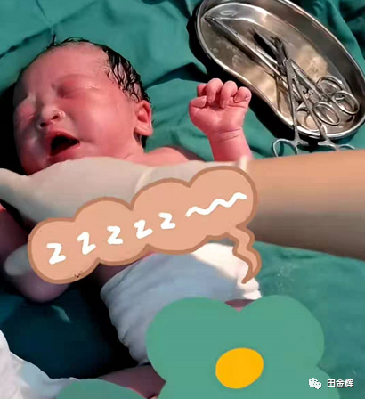 为什么剪脐带要先夹住【孕校素材】新生儿出生后抓住剪子不松手，被抢走后放声大哭，剪脐带会痛吗？_https://www.jmylbn.com_新闻资讯_第2张