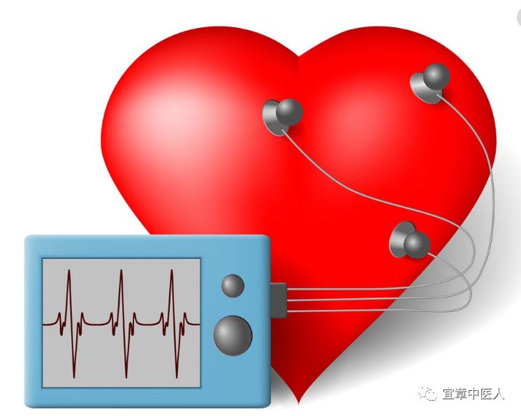 心电监护f n是什么心电监护看不懂？5点教你轻松玩转_https://www.jmylbn.com_新闻资讯_第2张