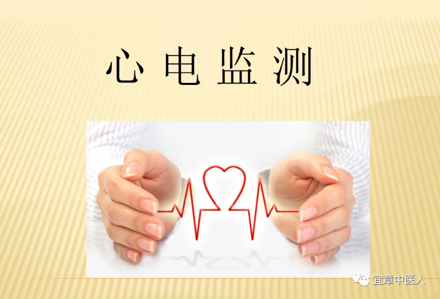 心电监护f n是什么心电监护看不懂？5点教你轻松玩转_https://www.jmylbn.com_新闻资讯_第3张