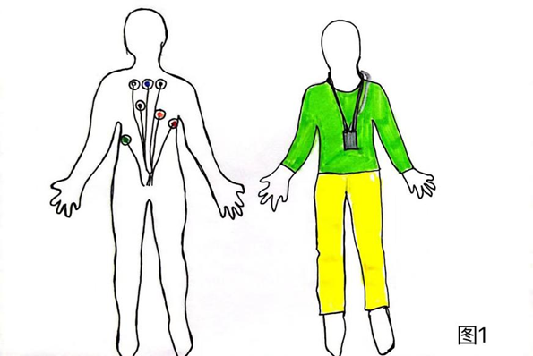 动态心电图仪器怎么看科普｜带您了解动态心电图和动态血压_https://www.jmylbn.com_新闻资讯_第1张