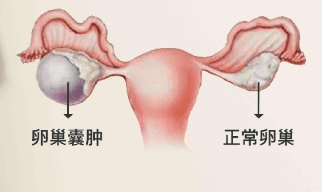 b超md是什么意思阴道出血10天！竟是它在“搞鬼”，定期B超很重要！_https://www.jmylbn.com_新闻资讯_第4张