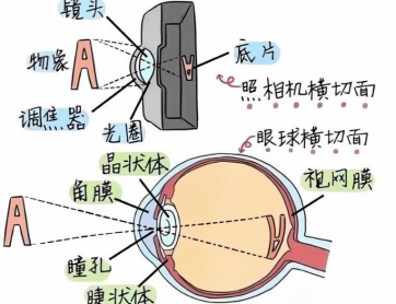 眼底照相有什么用眼底拍张照，眼病早知道！你的眼睛需要拍照吗？_https://www.jmylbn.com_新闻资讯_第5张