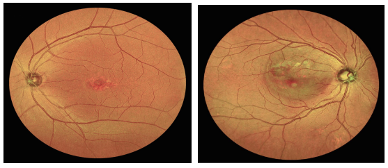 眼底照相有什么用眼底拍张照，眼病早知道！你的眼睛需要拍照吗？_https://www.jmylbn.com_新闻资讯_第13张