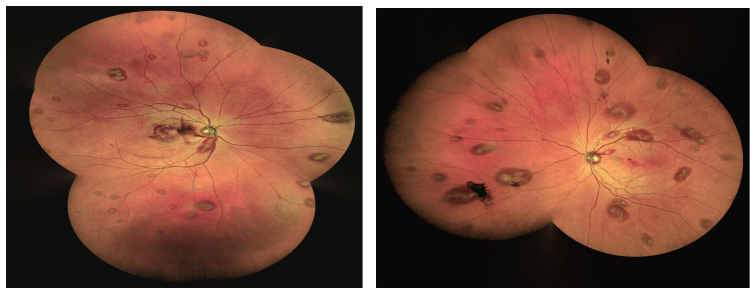 眼底照相有什么用眼底拍张照，眼病早知道！你的眼睛需要拍照吗？_https://www.jmylbn.com_新闻资讯_第12张