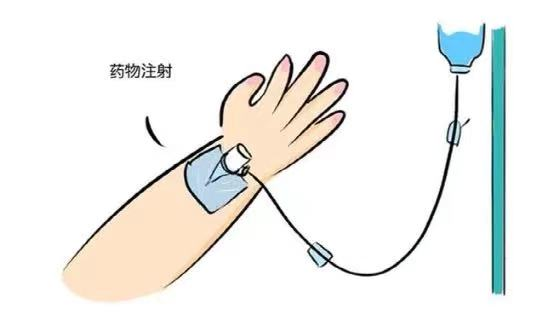 为什么输血不能用小针麻醉科手术室“针”不一样_https://www.jmylbn.com_新闻资讯_第3张