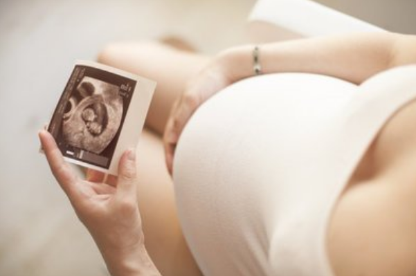 ge彩超是什么美国进口GE-E10高清四维彩超，遇见腹中最好的Ta~_https://www.jmylbn.com_新闻资讯_第3张