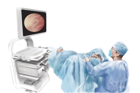 b膀胱镜为什么消毒不明原因血尿，莫慌，快用膀胱镜追查真相！_https://www.jmylbn.com_新闻资讯_第5张