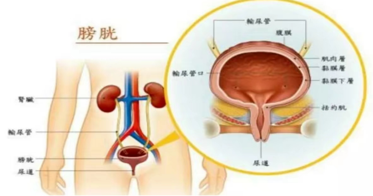 b膀胱镜为什么消毒不明原因血尿，莫慌，快用膀胱镜追查真相！_https://www.jmylbn.com_新闻资讯_第19张
