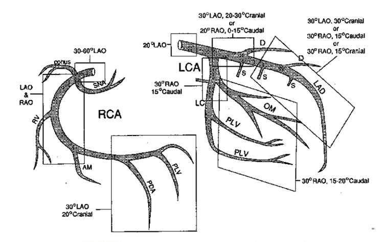 如何进行高质量的冠脉造影阜外教授这样说gwicc2019