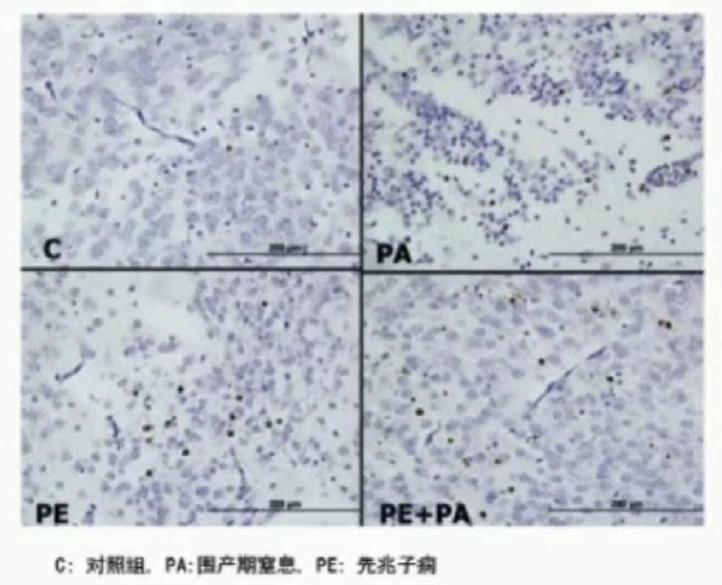 影響寶寶腦發育的4個因素，孕媽們可要注意了！ 親子 第8張