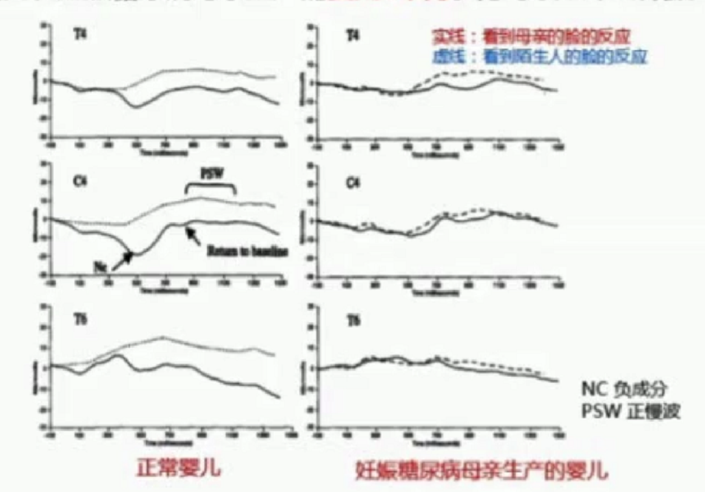 影響寶寶腦發育的4個因素，孕媽們可要注意了！ 親子 第10張