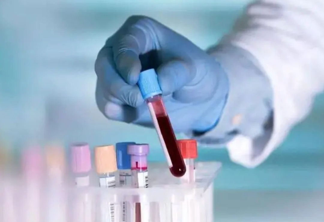 血液分析检查什么1分钟搞懂，血细胞分析5类，究竟是查什么？_https://www.jmylbn.com_新闻资讯_第1张