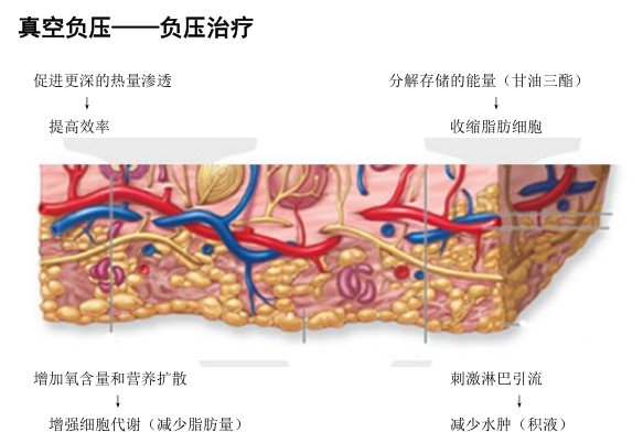 双极刀怎么画前沿速递 ｜ 逆龄黑科技，以色列威拉刀多功能仪器是你的菜吗？_https://www.jmylbn.com_新闻资讯_第6张