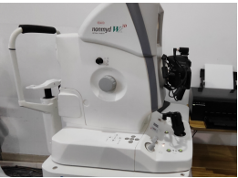 眼底照相有什么用同样是眼底照相，“大芒果”和“大橙子”有什么区别？_https://www.jmylbn.com_新闻资讯_第2张