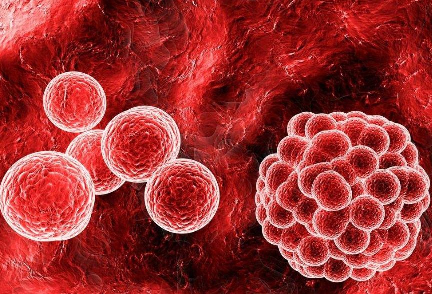 鼻咽癌早期症状你又知道多少？