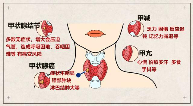 甲状腺激素有促进大脑发育,体格生长,营养代谢,完善神经和心血管功能