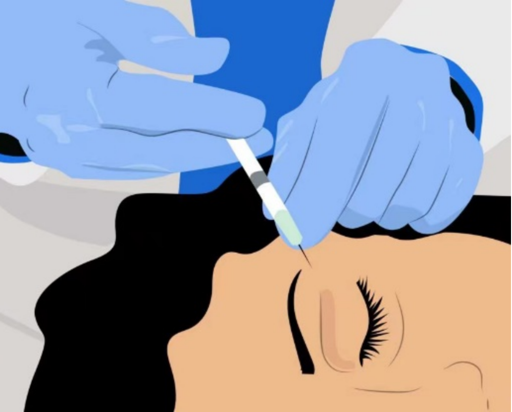 红光治疗怎么用中国研究：薇旖美人源化Ⅲ型胶原蛋白联合红光治疗在皮肤美容中的应用效果_https://www.jmylbn.com_新闻资讯_第6张