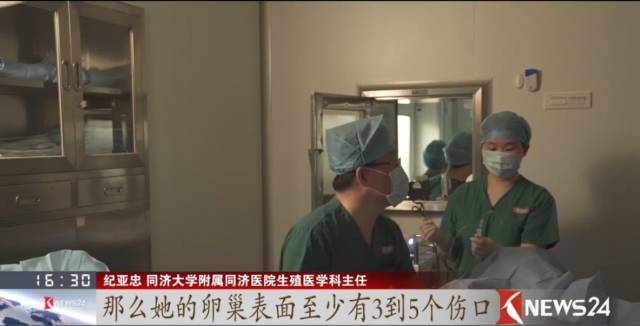 取卵针长什么样取卵的真相_https://www.jmylbn.com_新闻资讯_第10张